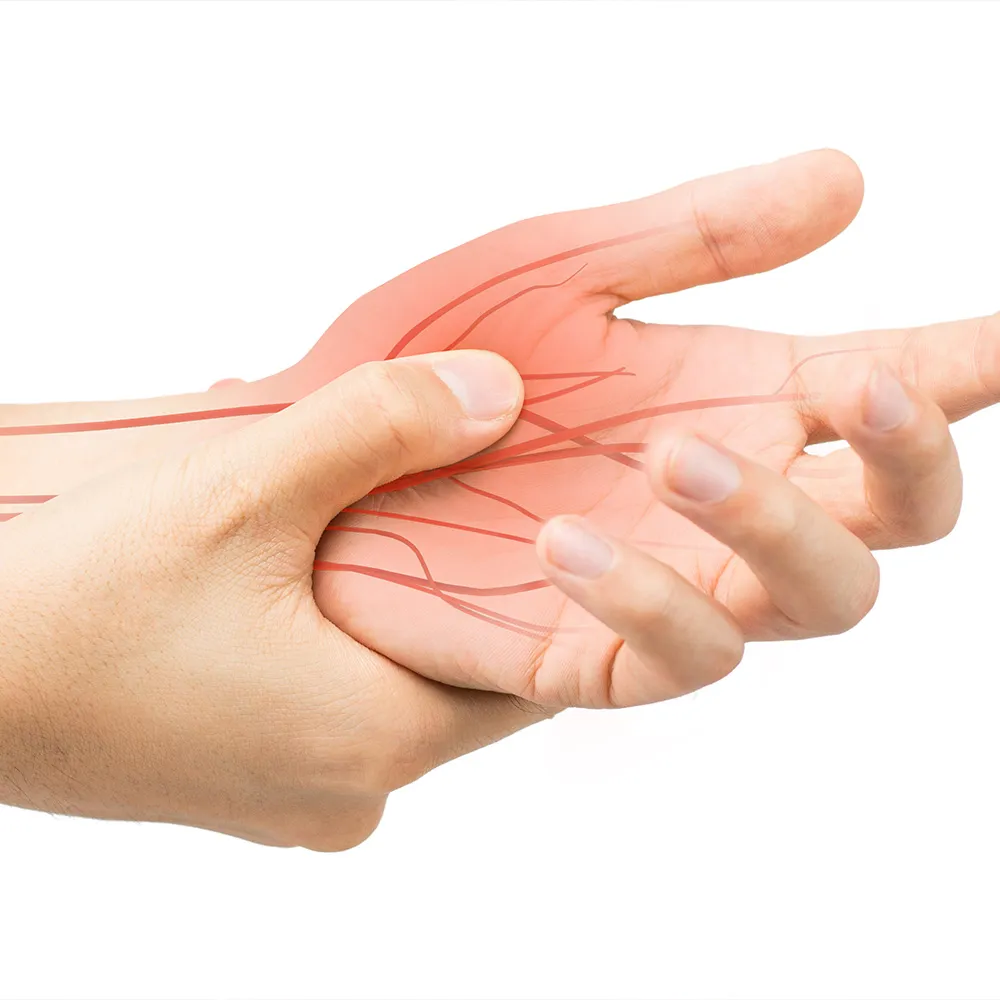 Palm nerves illustration depicting nerve pain