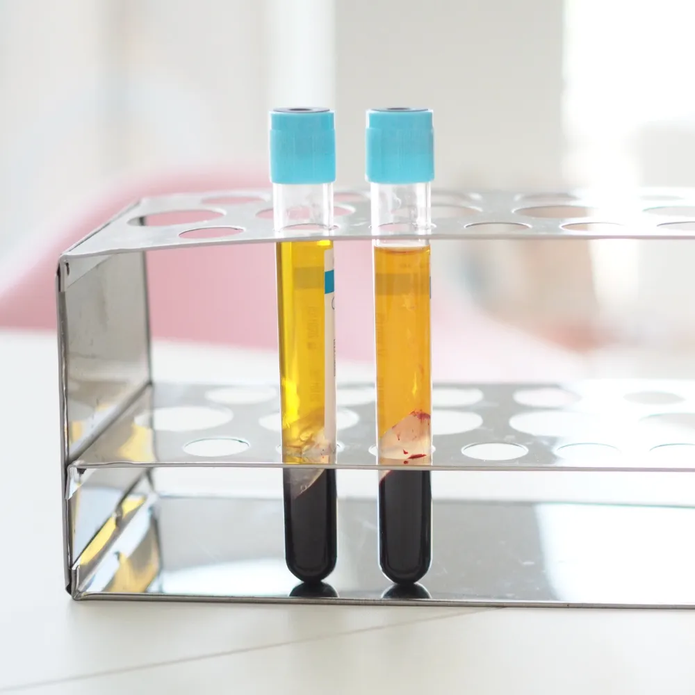 Blood samples in laboratory tubes  