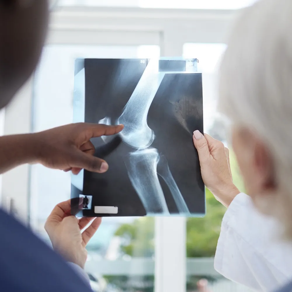 Doctor showing patient knee X-ray  