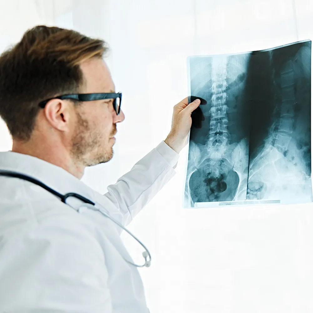 Doctor reviewing X-ray scan