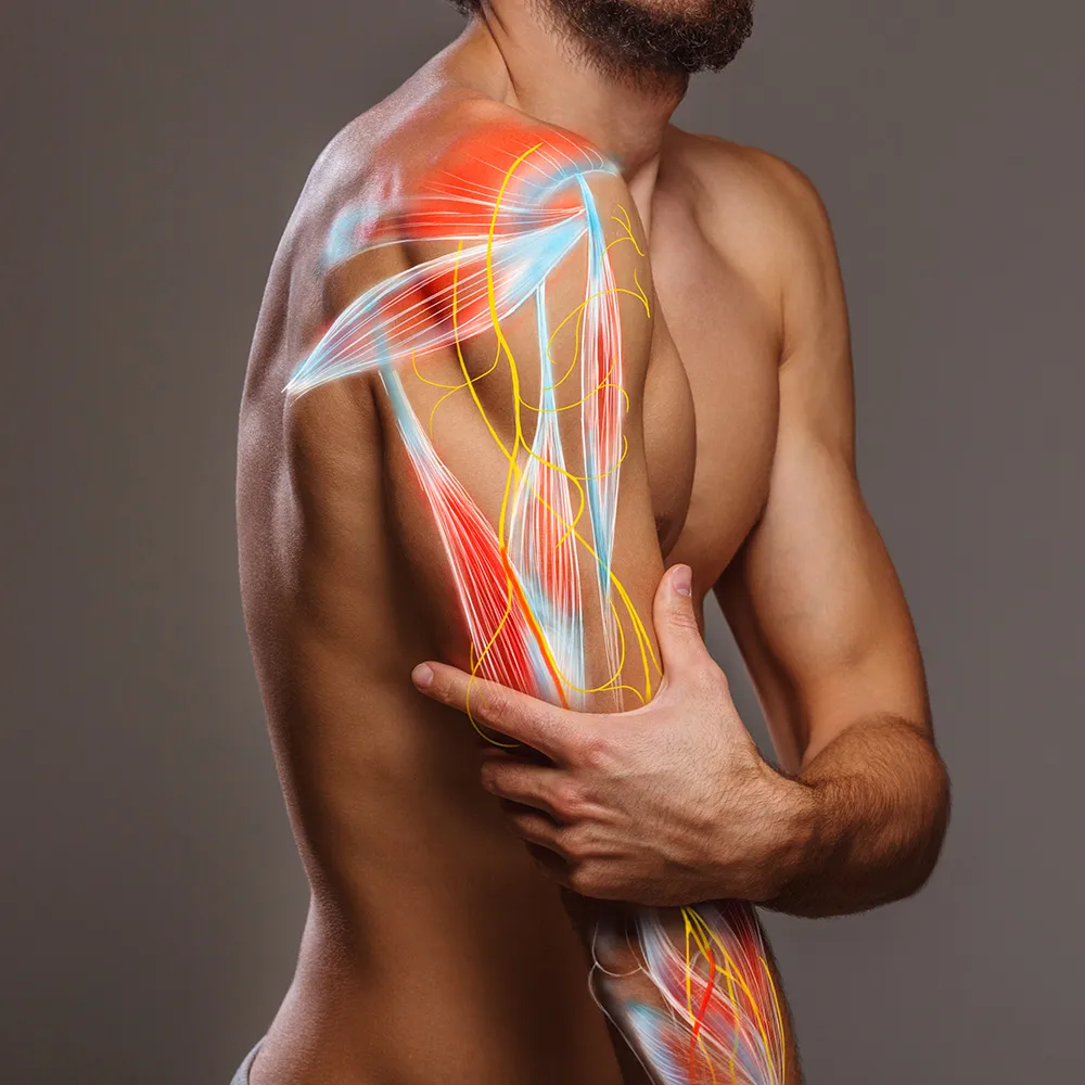 Arm muscles highlighted with nerve pain