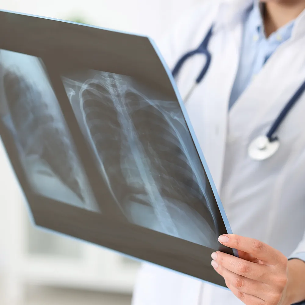 Doctor reviewing X-ray images  